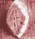 Patout, Emile  