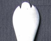trefid spoon terminal
